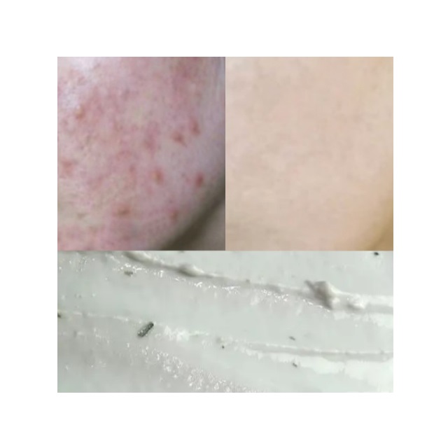 Korean Supplied Beauty Product Oem Odm Private Label Premium Skin Care Product Wholesale Price Tea-tree Diatomite Modeling Mask 