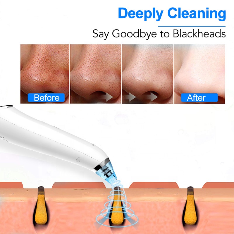 Multi-functional Skin Tightening Device Home Use Beauty Equipment Instrument Face Massage Skin Care Tools Beauty Products 