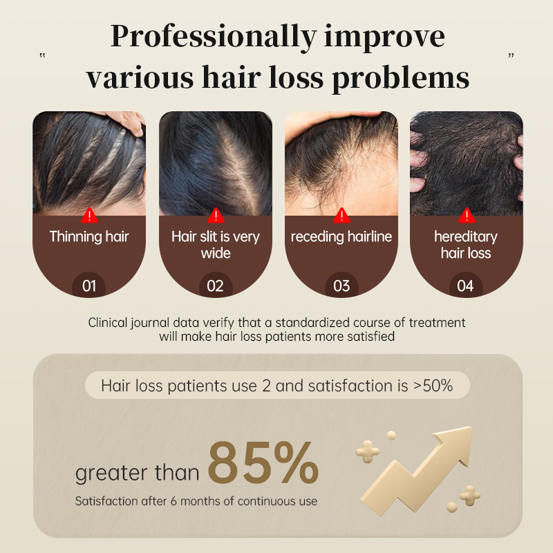 ?Japan NO.1? Hair Tonic Hair Growth Essence Conditioner Hair Treatment Anti Hair Loss Treatment Prevent Baldness Fast Promotes Hair Growth For man and woman 生发喷雾 50ML