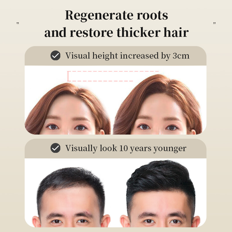 ?Japan NO.1? Hair Tonic Hair Growth Essence Conditioner Hair Treatment Anti Hair Loss Treatment Prevent Baldness Fast Promotes Hair Growth For man and woman 生发喷雾 50ML