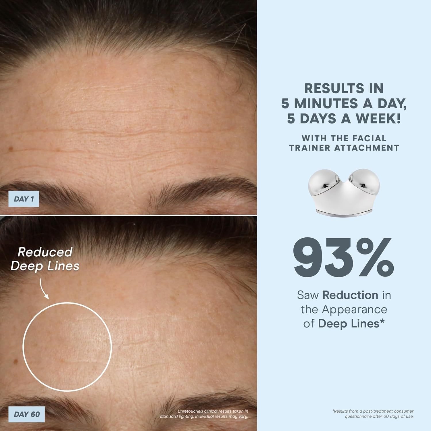 NuFACE TRINITY+ Microcurrent Facial Device Kit - Limited Edition FDA Cleared Facial Massager Device + Microcurrent Gel Activator, Cleansing Wipes and Brush - Velvet Rose